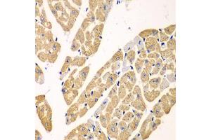 Immunohistochemistry of paraffin-embedded mouse heart using KYNU antibody (ABIN5973997) at dilution of 1/100 (40x lens). (KYNU Antikörper)