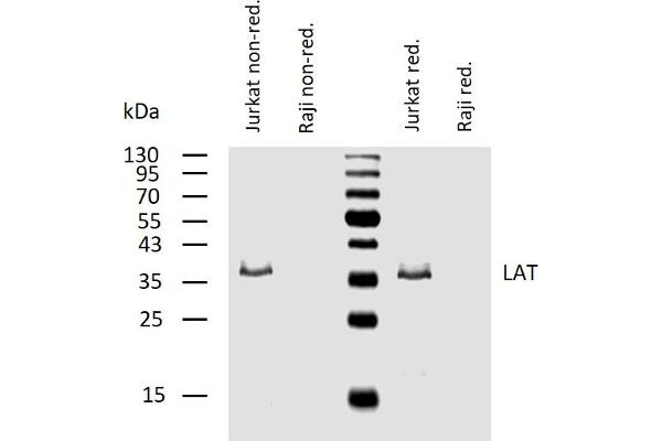 LAT Antikörper  (Cytoplasmic Domain)