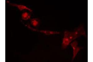 ABIN6274455 staining Hela cells by IF/ICC. (CDKL2 Antikörper  (Internal Region))