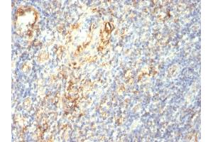 Immunohistochemistry (IHC) image for anti-Transglutaminase 2 (C Polypeptide, Protein-Glutamine-gamma-Glutamyltransferase) (TGM2) antibody (ABIN6940725)