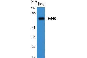 Western Blot (WB) analysis of specific cells using FSHR Polyclonal Antibody.