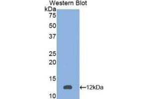 Western Blotting (WB) image for Peroxisomal Biogenesis Factor 2 (PEX2) ELISA Kit (ABIN6574173)