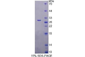 Image no. 1 for MFNG (MFNG) (AA 73-310) protein (His tag) (ABIN6238245)