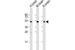 Western Blotting (WB) image for anti-Neuronal Pentraxin 1 (NPX1) (AA 322-350) antibody (ABIN652309)