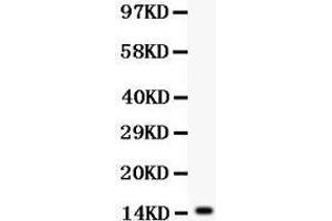 Anti- IL15 antibody, Western blotting All lanes: Anti IL15  at 0. (IL-15 Antikörper  (AA 49-162))