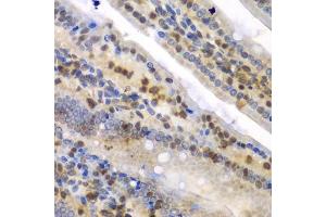Immunohistochemistry (Paraffin-embedded Sections) (IHC (p)) image for anti-Synaptotagmin Binding, Cytoplasmic RNA Interacting Protein (SYNCRIP) (AA 1-200) antibody (ABIN6148764)