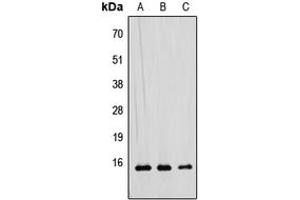 Western blot analysis of RAD52B expression in HEK293T (A), Raw264. (RDM1 Antikörper  (Center))