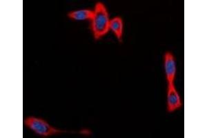 Immunofluorescent analysis of CYB561D1 staining in MCF7 cells. (CYB561D1 Antikörper  (C-Term))