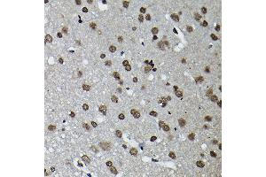 Immunohistochemistry of paraffin-embedded rat brain using Cyclin K Rabbit pAb (ABIN6128996, ABIN6138098, ABIN6138099 and ABIN6214445) at dilution of 1:100 (40x lens). (Cyclin K Antikörper  (AA 1-160))