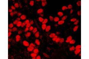 anti-High Mobility Group Nucleosome Binding Domain 1 (HMGN1) (AA 90-100) antibody