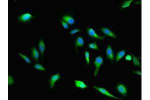 Immunofluorescent analysis of Hela cells using ABIN7166275 at dilution of 1:100 and Alexa Fluor 488-congugated AffiniPure Goat Anti-Rabbit IgG(H+L) (VAC14 Antikörper  (AA 333-523))