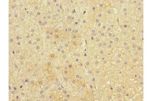Immunohistochemistry (IHC) image for anti-Interleukin 28 Receptor, alpha (Interferon, lambda Receptor) (IL28RA) (AA 21-228) antibody (ABIN6098644)