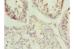 Immunohistochemistry of paraffin-embedded human testis tissue using ABIN7157235 at dilution of 1:100 (KANSL3 Antikörper  (AA 1-200))