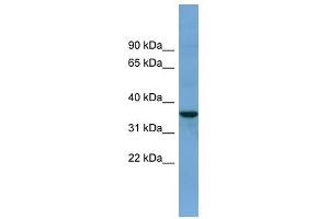 BACE2 antibody used at 1 ug/ml to detect target protein.