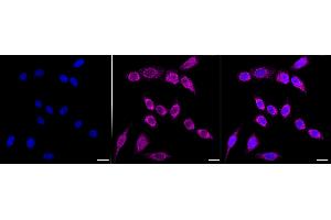 Immunocytochemical staining of HepG2 cells with Carbamoyl-phosphate synthase 1 antibody (ABIN7797865), 1:1,000).