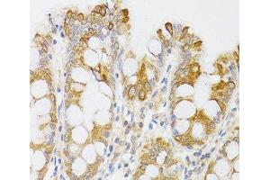 Immunohistochemistry of paraffin-embedded Human rectum using MYO5A Polyclonal Antibody at dilution of 1:100 (40x lens). (MYO5A Antikörper)