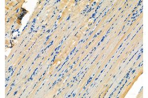 ABIN6260446 and ABIN6276575 at 1/100 staining Rat muscle tissue by IHC-P. (CAPNL1 Antikörper  (N-Term))