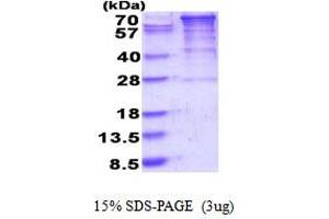 SDS-PAGE (SDS) image for Eukaryotic Elongation Factor-2 Kinase (EEF2K) (AA 1-725) protein (His tag) (ABIN6387490)