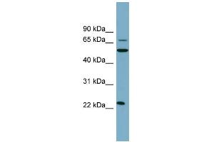 Western Blotting (WB) image for anti-C-Type Lectin Domain Family 6, Member A (CLEC6A) (N-Term) antibody (ABIN2781914)