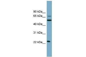 WB Suggested Anti-CLEC6A Antibody Titration:  0. (C-Type Lectin Domain Family 6, Member A (CLEC6A) (N-Term) Antikörper)
