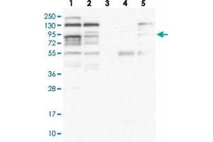 Western blot analysis of Lane 1: RT-4, Lane 2: U-251 MG, Lane 3: Human Plasma, Lane 4: Liver, Lane 5: Tonsil with ZNF227 polyclonal antibody  at 1:100-1:250 dilution. (ZNF227 Antikörper)