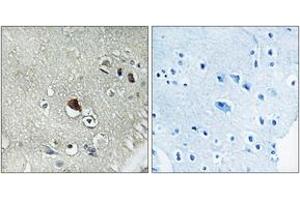 Immunohistochemistry (IHC) image for anti-Dishevelled, Dsh Homolog 3 (Drosophila) (DVL3) (AA 326-375) antibody (ABIN2890609) (DVL3 Antikörper  (AA 326-375))