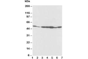 Western blot testing of alpha 2a Adrenergic Receptor antibody and Lane 1:  rat testis;  2: rat brain;  3: MCF-7;  4: MM453;  5: SMMC-7721;  6: HeLa;  7: COLO320 cell lysate (ADRA2A Antikörper  (C-Term))
