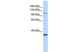 Image no. 1 for anti-Minichromosome Maintenance Complex Component 2 (MCM2) (AA 828-877) antibody (ABIN6742706) (MCM2 Antikörper  (AA 828-877))