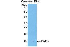Western blot analysis of the recombinant protein. (Fibulin 5 Antikörper  (AA 170-243))