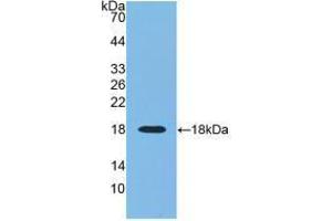 Western blot analysis of recombinant Human RNASE3. (RNASE3 Antikörper  (AA 30-154))