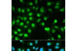 Immunofluorescence analysis of HeLa cells using PPP3CA Polyclonal Antibody (PPP3CA Antikörper)
