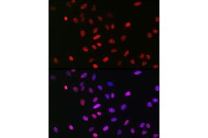 Immunofluorescence analysis of U2OS cells using MonoMethyl-Histone H3-K18 Rabbit mAb (ABIN7267683) at dilution of 1:100 (40x lens).
