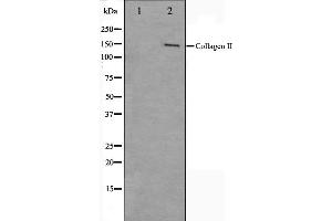 Western blot analysis on COLO205 cell lysate using Collagen II Antibody,The lane on the left is treated with the antigen-specific peptide. (COL2A1 Antikörper  (N-Term))