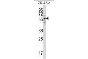 Western blot analysis in ZR-75-1 cell line lysates (35ug/lane).