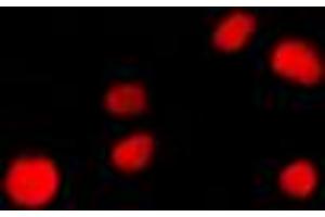 Immunofluorescent analysis of NUP160 staining in NIH3T3 cells. (NUP160 Antikörper  (Center))