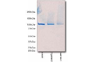 SDS-PAGE/Coomassie Blue staining of poly(ADP-ribose) automodified PARP1. (PARP1 Protein)
