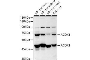 Western blot analysis of extracts of various cell lines, using  antibody (ABIN6131168, ABIN6136442, ABIN6136443 and ABIN6224114) at 1:500 dilution. (ACOX1 Antikörper  (AA 1-270))