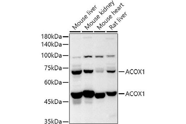 ACOX1 anticorps  (AA 1-270)