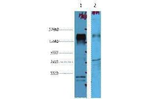 Western Blotting (WB) image for anti-Receptor tyrosine-protein kinase erbB-2 (ErbB2/Her2) antibody (ABIN3178598) (ErbB2/Her2 Antikörper)