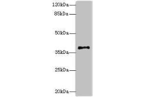 Western blot All lanes: PLCXD1 antibody at 2 μg/mL + Jurkat whole cell lysate Secondary Goat polyclonal to rabbit IgG at 1/10000 dilution Predicted band size: 37 kDa Observed band size: 37 kDa