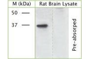 WB on rat brain lysate using Rabbit antibody to phospho S41 of Axonal membrane protein GAP-43 (Neuromodulin, growth-associated protein 43): IgG (ABIN350110) at 50 µg/ml concentration incubated overnight at 4°C. (GAP43 Antikörper  (pSer41))