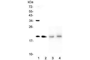 Western blot testing of 1) human HeLa, 2) human placenta, 3) rat lung and 4) mouse lung lysate with Dermatopontin antibody at 0. (Dermatopontin Antikörper  (AA 19-201))
