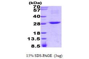 SDS-PAGE (SDS) image for Regulator of G-Protein Signaling 16 (RGS16) (AA 1-202) protein (His tag) (ABIN667771) (RGS16 Protein (AA 1-202) (His tag))