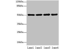 Western blot All lanes: CEACAM1 antibody at 10 μg/mL Lane 1: HT29 whole cell lysate Lane 2: HCT116 whole cell lysate Lane 3: COLO205 whole cell lysate Lane 4: HepG2 whole cell lysate Secondary Goat polyclonal to rabbit IgG at 1/10000 dilution Predicted band size: 58, 46, 36, 39, 51, 47, 28, 44, 52, 40 kDa Observed band size: 51 kDa (CEACAM1 Antikörper  (AA 35-428))