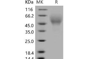 Western Blotting (WB) image for CD200 Receptor 4 (CD200R4) protein (His tag) (ABIN7320208) (CD200R4 Protein (His tag))