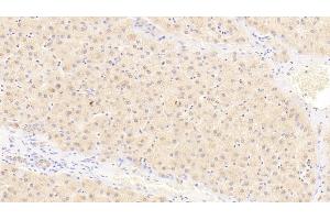 Detection of IL23a in Human Liver Tissue using Polyclonal Antibody to Interleukin 23 Subunit Alpha (IL23a) (IL23A Antikörper  (AA 20-189))