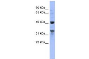 MRPL37 Antikörper  (AA 35-84)