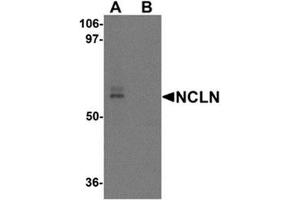 Western blot analysis of NCLN in mouse heart tissue lysate with NCLN antibody at 0. (Nicalin Antikörper  (C-Term))