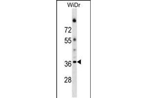 Western blot analysis in WiDr cell line lysates (35ug/lane). (ALG5 Antikörper  (AA 74-100))