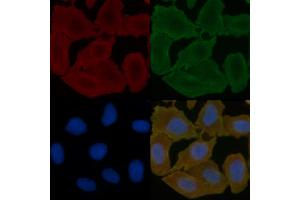 ABIN6257709 and ABIN6275139 staining Hela cells(30 min of UV treatment) by IF/ICC.